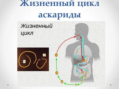 Плюс одна фобия в копилку | Пикабу