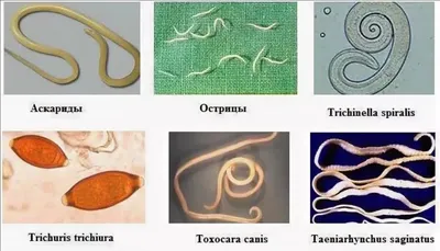 Strongyloides Stercoralis Является Человеком Паразитарные Аскариды Вызывает  Стронгилоидоз Заболевания. Фотография, картинки, изображения и  сток-фотография без роялти. Image 38282061