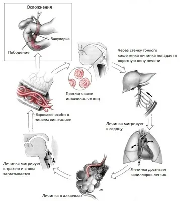 Аскариды. — TEST LAB