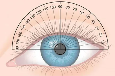 Астигматизм - что это, причины, симптомы, виды и степени заболевания,  диагностика, профилактика и методы лечения