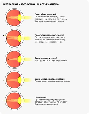 Астигматизм | Диагностика, симптомы, лечение | Центр Окулюс