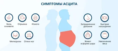 Асцит, причины, симптомы и лечение | Заболевания внутренних органов