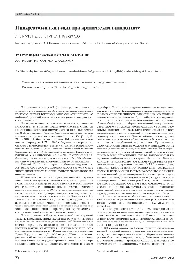 Асцит: лечение асцита легкой, умеренной, высокой степени (I, II, III) -  часть 2 | Университетская клиника