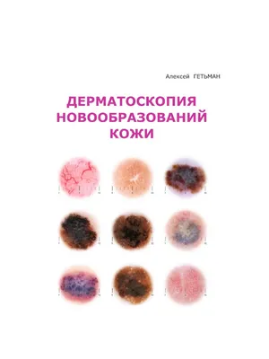 Книга Кожные и венерические болезни Владимир Владимиров, язык Русский,  заказать книги на Bookovka.ua