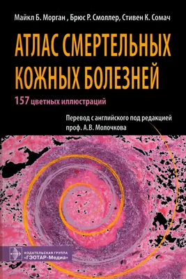 Атлас смертельных кожных болезней Морган М.Б., Смоллер Б.Р., Сомач С.К.  Издательство Гэотар, 2010 год