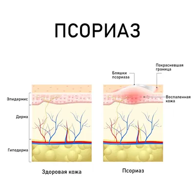 С 4 по 10 сентября – Неделя профилактики кожных заболеваний | 05.09.2023 |  Камышин - БезФормата