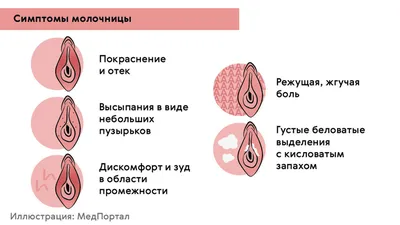 Симптомы кольпита: что обязательно знать