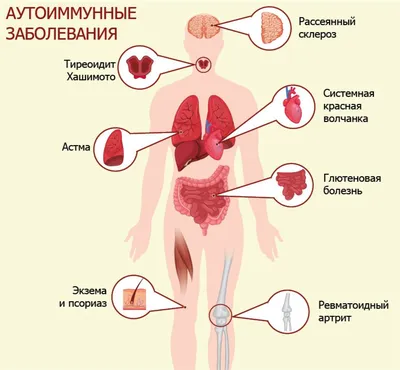 Аутоиммунные нарушения: разновидности, факторы возникновения и методы  лечения | Федеральный центр НМО | Дзен