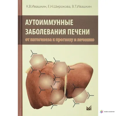 ПАТОГЕНЕЗ И ДИАГНОСТИКА ИММУНОПАТОЛОГИЧЕСКИХ СОСТОЯНИЙ: Аутоиммунные  заболевания – тема научной статьи по фундаментальной медицине читайте  бесплатно текст научно-исследовательской работы в электронной библиотеке  КиберЛенинка