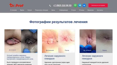 Фотографии результатов лечения в Ростове-на-Дону - клиника Doctor-Prof