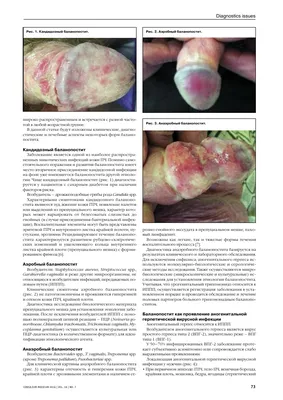 Клинико-диагностические аспекты некоторых форм баланопостита