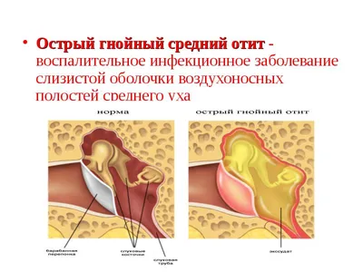 Анатомия: Барабанная перепонка, membrana tympani. Сосуды и нервы наружного  уха. Кровоснабжение наружного уха.