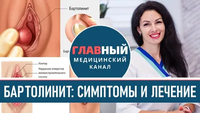 Шугаринг - БАРТОЛИНИТ ⠀ Ещё одна медицинская тема, которой... | Facebook