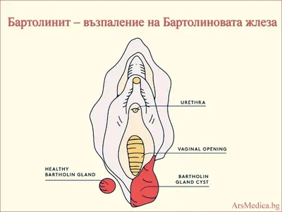 Бартолинит: Tetrabarteen (Тетрабартин) капсулы при бартолините  (ID#1399424755), цена: 520 ₴, купить на Prom.ua