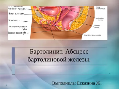 Симптомы и стадии развития бартолинита — блог медицинского центра ОН Клиник