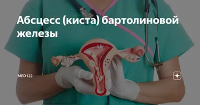 Удаление кисты бартолиновой железы