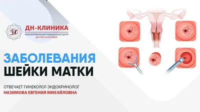 Средства, стимулирующие регенерацию Stada / Нижфарм Левомеколь -  «Эффективная мазь при воспалении кисты бартолиновой железы и нарывах! Мазь,  которая всегда в моей аптечке. » | отзывы