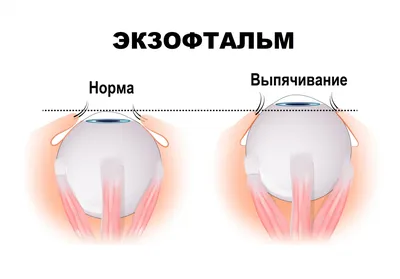 Вот это глазастик - модель Мария Оз с настораживающей внешностью (6 фото) |  Екабу.ру - развлекательный портал