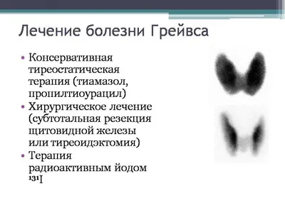 Говорят, какая я ужасная, неприятная, отвратительная»: Софья Эрнст о  реакции зрителей на сериал «Содержанки» - лайфстайл - 18 апреля 2019 -  фотографии - Кино-Театр.Ру