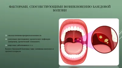 О здоровье, медицине и науке простыми словами on X: \"Интересные факты о Базедовой  болезни #базедоваболезнь https://t.co/nEstQhHuTt\" / X