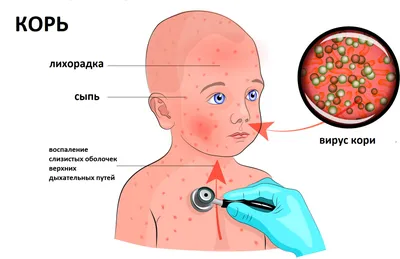 Почему болит горло с одной стороны | Новости Аркада-Мед