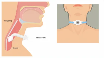 Чем болеют дети в детском саду: инфекционные болезни, их симптомы и  профилактика