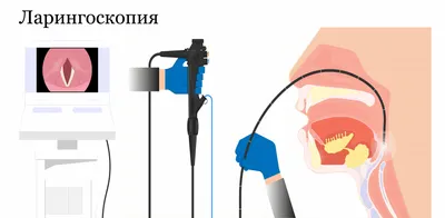 Белый налет на языке - что это значит и как от него избавиться? | Полезные  советы - блог стоматологической клиники Complex Dent в Киеве