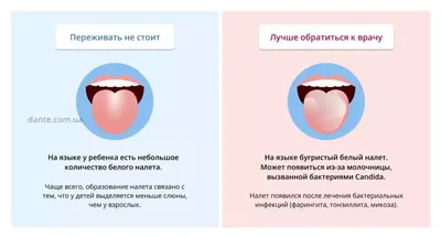 Желтый налет на языке — причины и лечение, о чем говорит, признак какого  заболевания в статье на Startsmile.ru