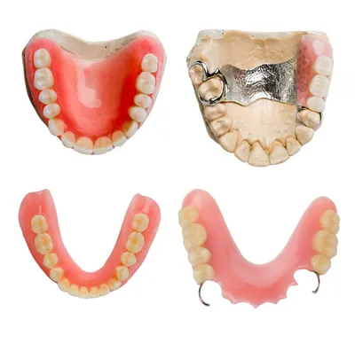 Бюгельное протезирование: можно ли естественно улыбаться с протезами во рту?  – полезная информация, стоматология ЛидерСтом в Москве