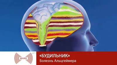 Названы \"глазные симптомы\" болезни Альцгеймера | 17.03.2022, ИноСМИ