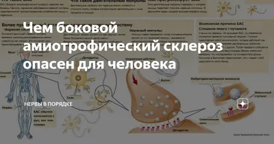 Ниночка. Не быть взаперти « Новости | ГАООРДИ — Ассоциация родителей  детей-инвалидов