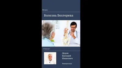 В Уфе скульптуры расскажут о болезни Бехтерева. Как живут люди с этим  заболеванием? - Новости - Уфа - UTV