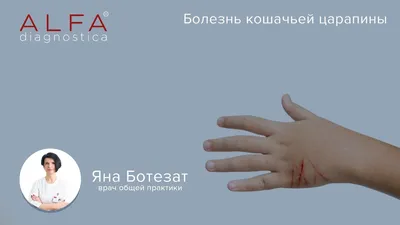 Болезнь кошачьих царапин - профилактика, лечение