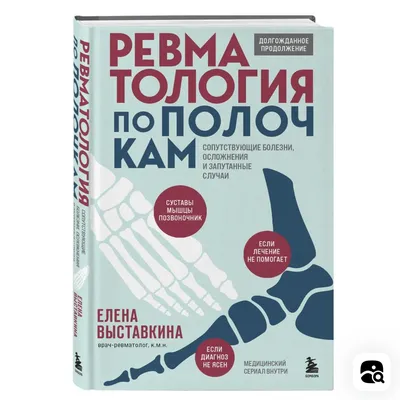 Болезнь кошачьих царапин – что это такое и какие симптомы - Pets