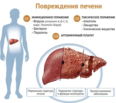 Кожный зуд: виды, причины возникновения, диагностика и лечение, при  заболеваниях печени, какой врач лечит - 2 октября 2022 - Sport24