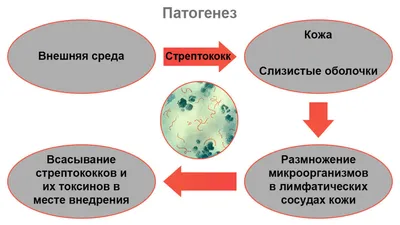 Рожистое воспаление голени - флегмона | Пикабу