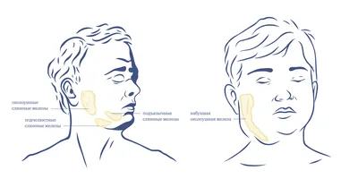 Характерные свойства опасной болезни с забавным названием Свинка |  Кстати.news Иваново