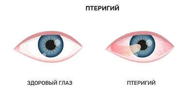 Показания для операции на глазах у кошек - ветклиника \"в Добрые Руки\"