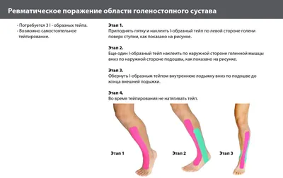 Обзор болезней стопы и голеностопного сустава (Overview of Foot and Ankle  Disorders) - Нарушения со стороны скелетно-мышечной и соединительной ткани  - Справочник MSD Профессиональная версия