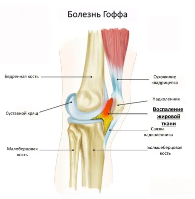 Бандаж на голеностопный сустав с пластинами Т-8608/1 - купить по выгодной  цене | Ортопедический салон Здоровье