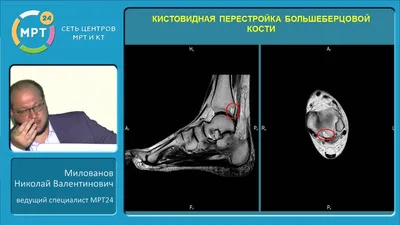 Болит голеностопный сустав - Первая Медицинская Клиника