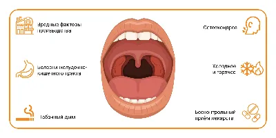 Болезни горла фото