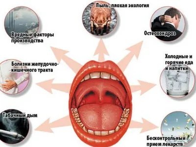 Красное горло: причины, диагностика и лечение у детей и взрослых