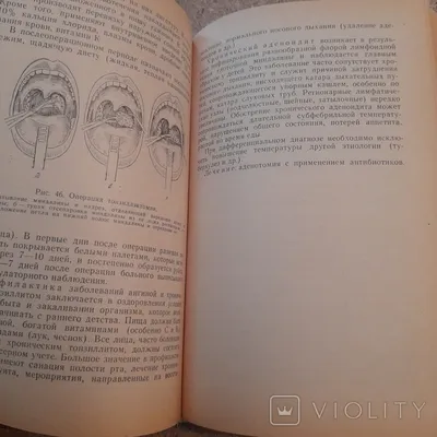 Гладков \"Болезни уха горла и носа\" 1973 – на сайте для коллекционеров  VIOLITY | Купить в Украине: Киеве, Харькове, Львове, Одессе, Житомире