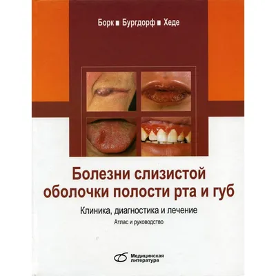 Герпес после увеличения губ: как лечить и кто виноват