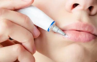 О чем сигналит привычка кусать губы: врачи назвали 6 болезней | DOCTORPITER