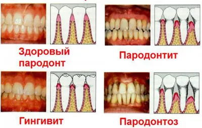 Что вызывает прикусывание губ. Как с этим бороться? | Новости Аркада-Мед