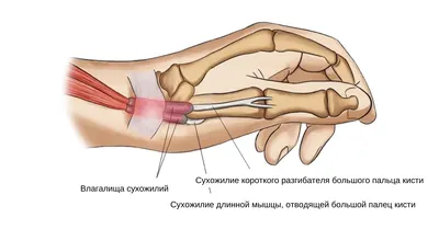 Болезни, связанные с неправильной игрой на гитаре