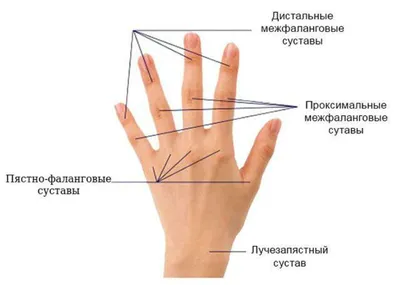 Жжение в руках: причины и лечение, почему горят кисти и ладони рук |  Клиника TEMED