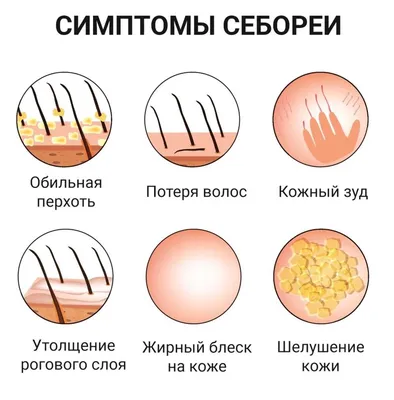 Кожные заболевания - причины, симптомы, диагностика и лечение болезней кожи